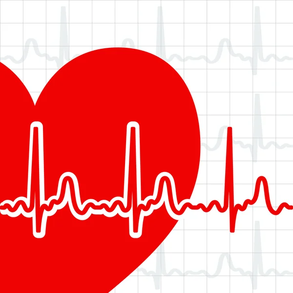 Cardiogramma cardiaco — Vettoriale Stock