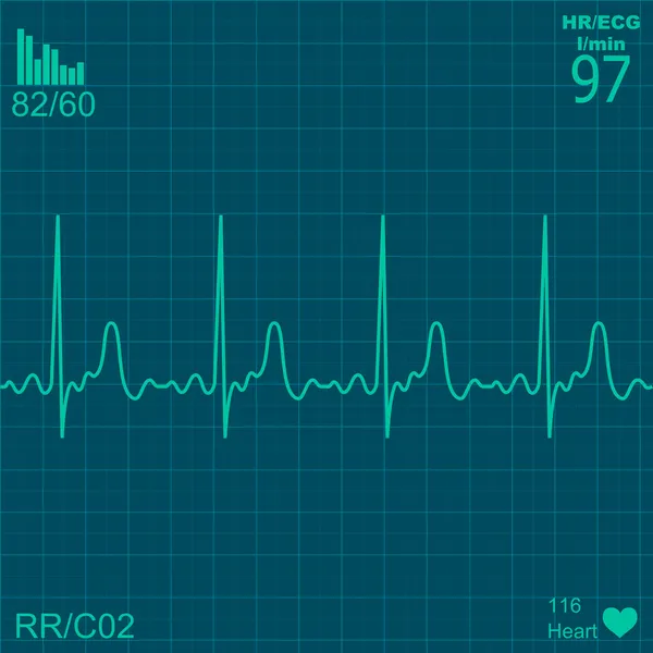 心脏监视器 — 图库矢量图片