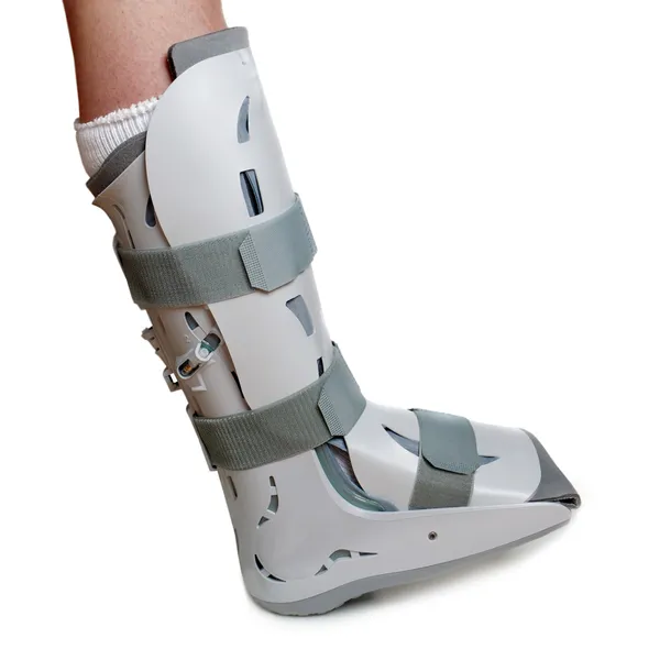 Severe ankle sprain — Stock Photo, Image