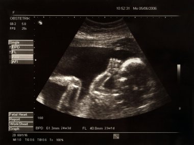 Picture of a baby in the belly of her mother clipart