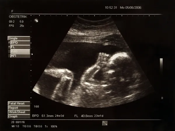 Imagen de un bebé en el vientre de su madre —  Fotos de Stock