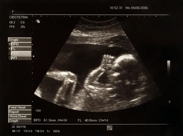 Foto van een baby in de buik van de moeder Stockfoto