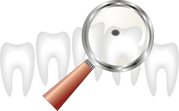 Caries dental bajo lupa, odontología — Archivo Imágenes Vectoriales