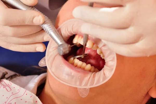牙医 — 图库照片