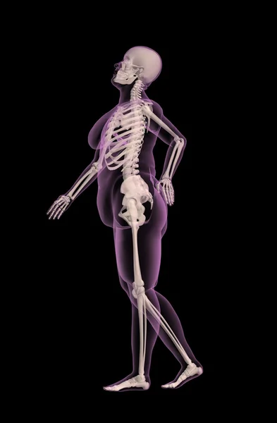 Избыточный женский медицинский скелет с болью в спине — стоковое фото