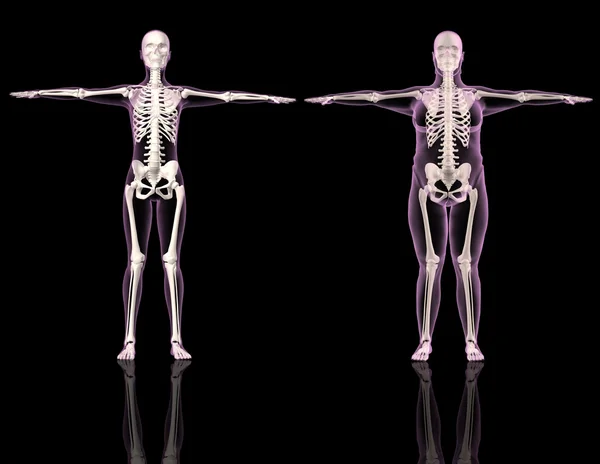 Esqueletos femeninos médicos uno delgado y otro con sobrepeso — Foto de Stock