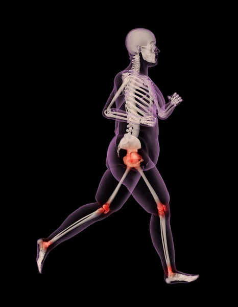 Nadwagę kobieta medyczny szkielet działa — Zdjęcie stockowe