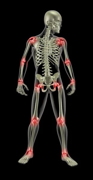 Medische skelet — Stockfoto