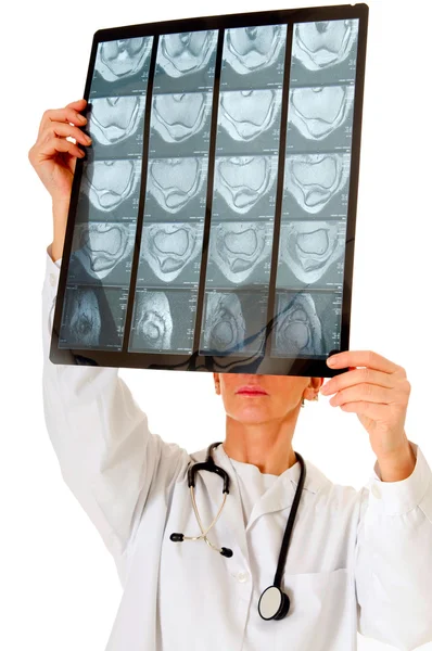 Médico que examina una RMN de rayos X — Foto de Stock