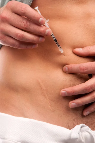 First Type Diabetes Patient Giving Himself Abdomen Insulin Injection Shot — Stock Photo, Image