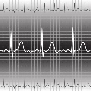 Electrocardiogram clipart