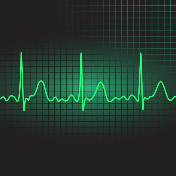 Électrocardiogramme Illustration Vectorielle Eps10 — Image vectorielle