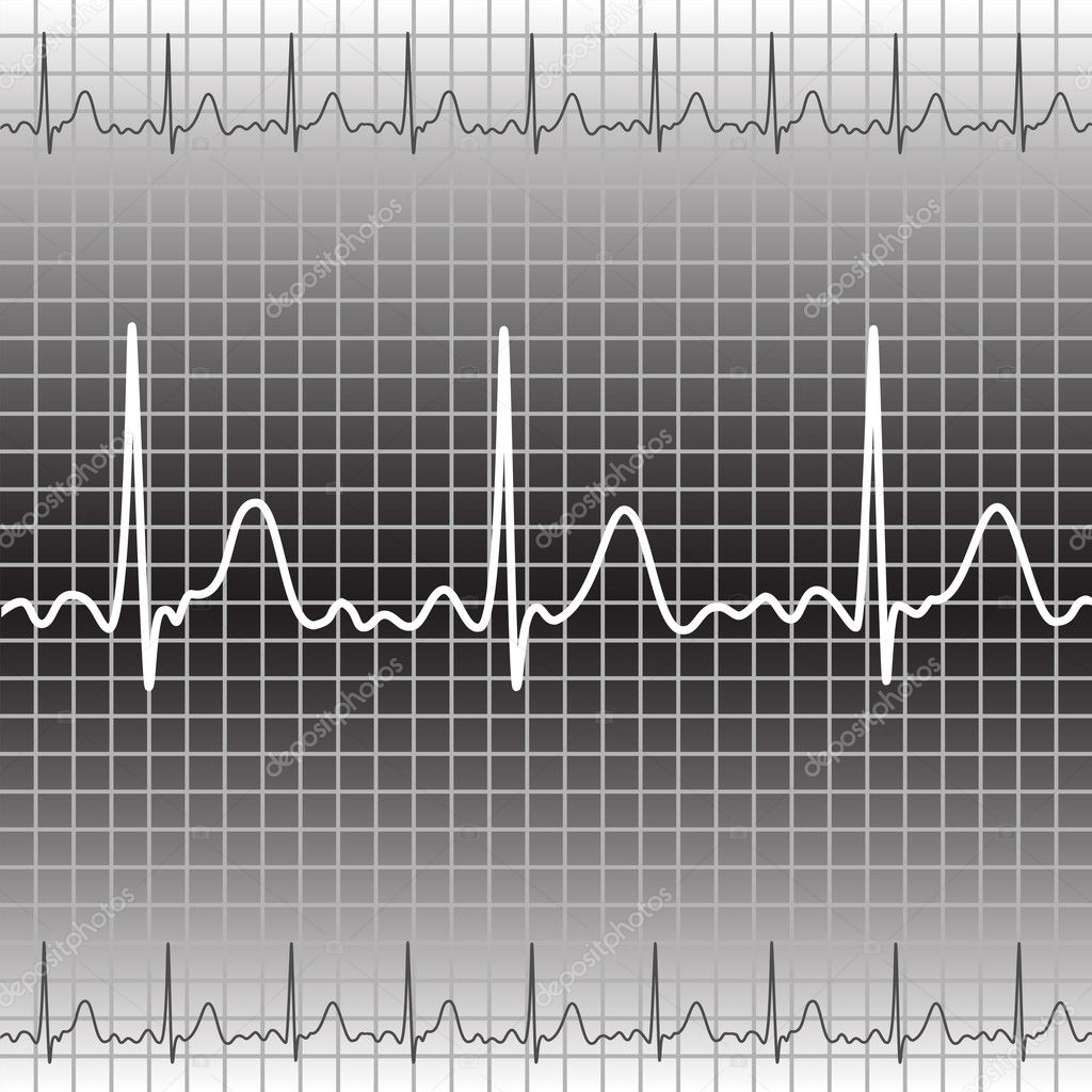 Electrocardiogram — Stock Vector © sanya85 #4671081