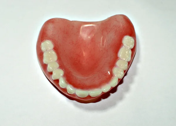 Prótese dentária removível  . — Fotografia de Stock