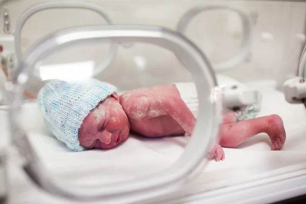 生まれたばかりの赤ちゃんは、インキュベーターで vertix で覆われています。 — ストック写真