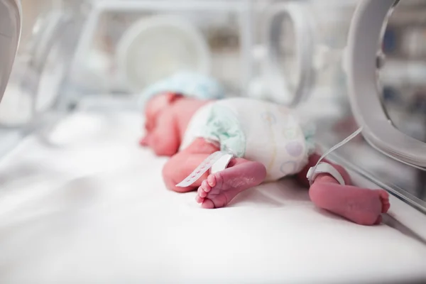 生まれたばかりの赤ちゃんの男の子のインキュベーター内 vertix で覆われています。 — ストック写真