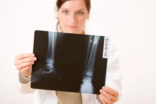 Médica feminina segurando raio-X — Fotografia de Stock