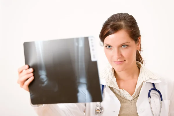 Női Orvos Gazdaság Röntgen Ellenőrzés Eredménye — Stock Fotó
