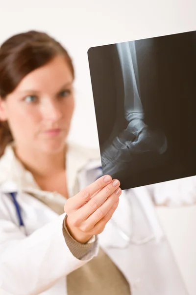 Kvinnliga Läkare Håller Röntgen Kontrollera Resultatet — Stockfoto