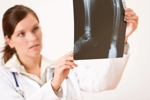 X-ray 촬영을 하는 여의사 — 스톡 사진