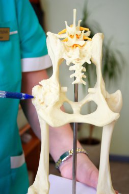 Hip dysplasia model of the dog clipart