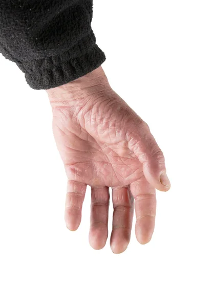 stock image Help hand