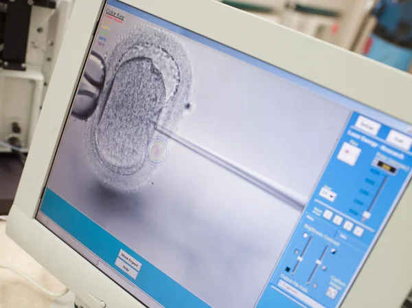 Monitor Zobrazuje Uvnitř Injekce Cytoplazmatické Spermie Icsi — Stock fotografie