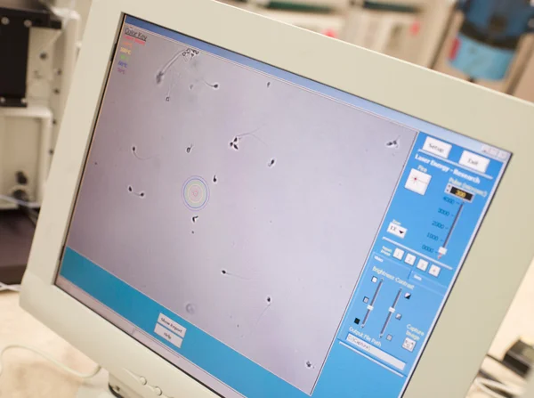 Monitor Mostrando Injeção Esperma Intra Citoplasmático Icsi — Fotografia de Stock