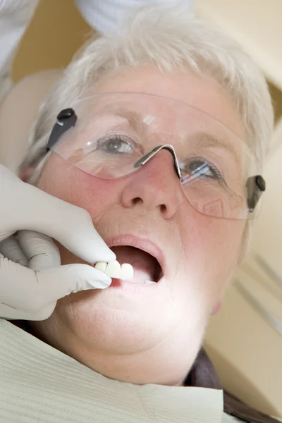 Zubař v místnosti zkoušku na ženu v křesle montáž protézy — Stock fotografie