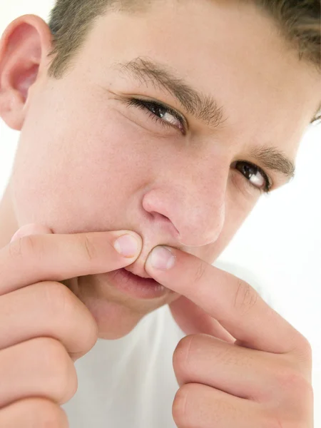 Teenage Boy Popping Zit Face — Stock Photo, Image