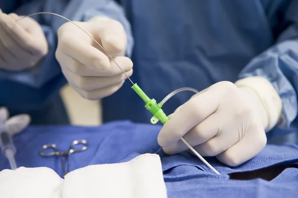 Tubo Inserção Cirurgião Paciente Durante Cirurgia — Fotografia de Stock