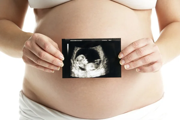 Detail Pregnant Woman Holding Ultrasound Scan — Stock Photo, Image