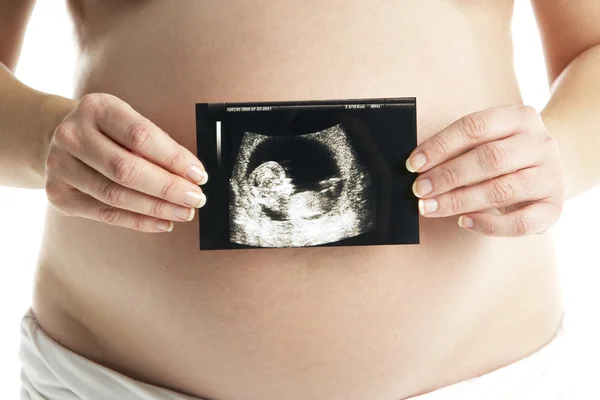 Detalle de la mujer embarazada que sostiene la exploración por ultrasonido —  Fotos de Stock