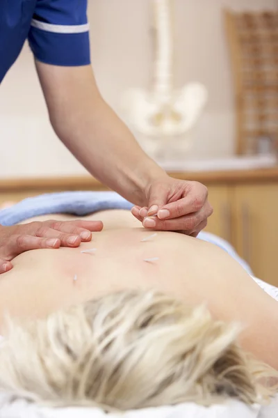 Acupuncturist treating female client — Stock Photo, Image