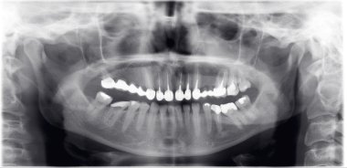 diş hekimi x-ray