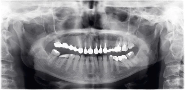 Stock image Dentist x-ray