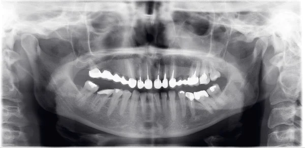 Radiografia del dentista Foto Stock Royalty Free