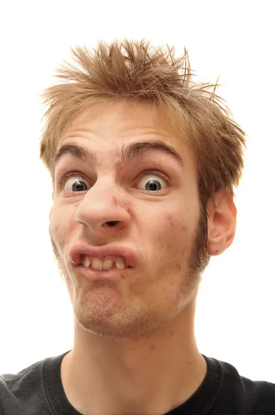 Человек Делает Странное Лицо Кривыми Зубами Изолированы Белом Фоне — стоковое фото