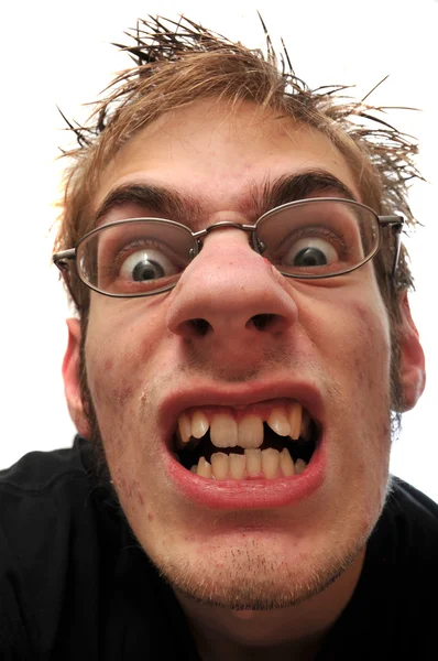 Θυμωμένος Άσχημος Άνδρας Γυαλιά Και Στραβά Δόντια Απομονώνονται Λευκό — Φωτογραφία Αρχείου