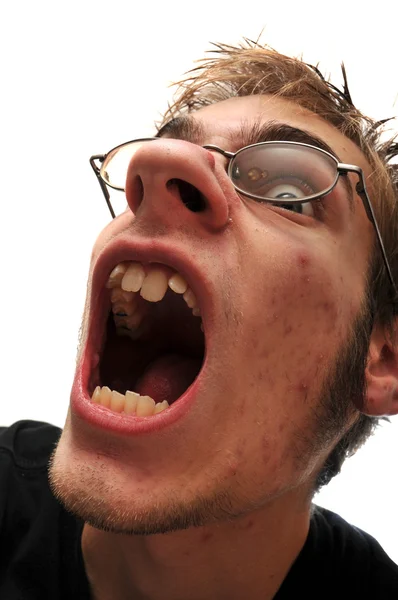 Άσχημος Άνδρας Στόμα Ανοιχτό Και Ακμή Φοράει Γυαλιά — Φωτογραφία Αρχείου
