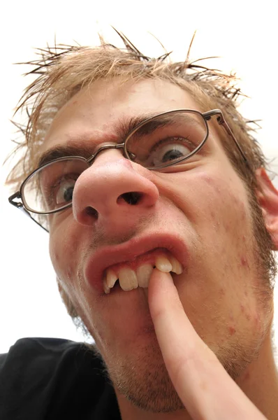 Потворний чоловік збирає свої криві зуби — стокове фото