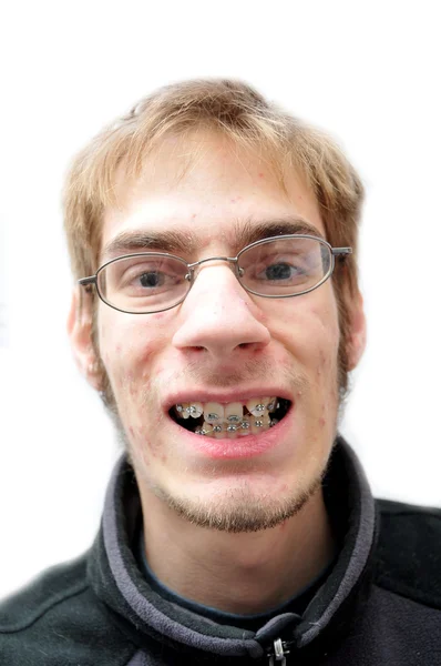 Νεαρός Άνδρας Που Προσπαθούν Χαμογελούν Τιράντες — Φωτογραφία Αρχείου