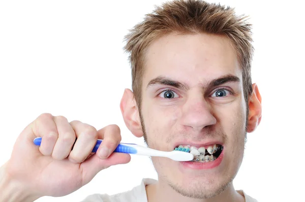 Young Adult Man Brushes Teeth Isolated White Has Braces — Stock Photo, Image