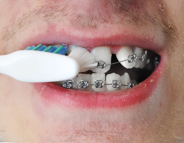 Jovem adulto homem escova os dentes — Fotografia de Stock