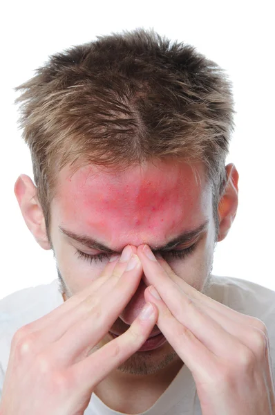 Young Adult Man Stressed Rubs His Eyes Pain Isolated White — Stock Photo, Image