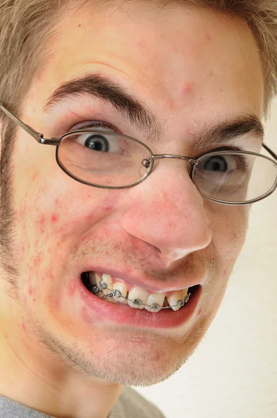 Junger Erwachsener Mann Knirscht Mit Den Zähnen Während Die Kamera — Stockfoto