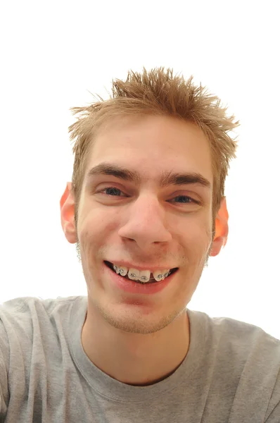 Teen diş teli ile gülüyor — Stok fotoğraf
