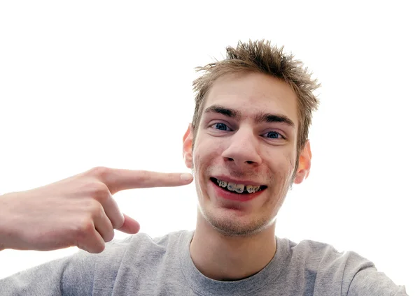 Joven adulto sonríe con aparatos ortopédicos — Foto de Stock