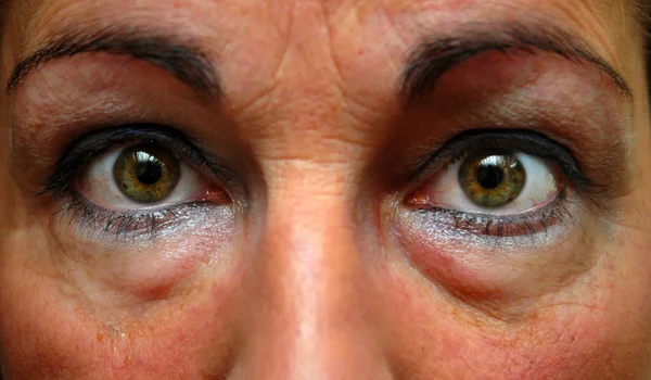 疲れた女性の目のクローズ アップ ストック画像