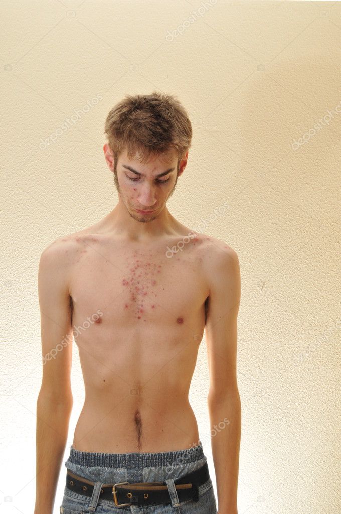 Skinny Chest of a Male Teenager Stock Image - Image of athletic, body:  136607117